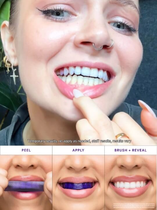hismile-v34-whitening-strips-04 (1)